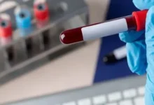 Exame de sangue para detectar Alzheimer chega ao Brasil e custa cerca de R$ 3 mil