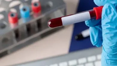 Exame de sangue para detectar Alzheimer chega ao Brasil e custa cerca de R$ 3 mil