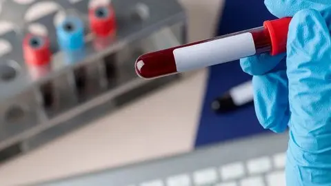 Exame de sangue para detectar Alzheimer chega ao Brasil e custa cerca de R$ 3 mil